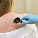 How to Prepare for a Skin Cancer Screening With Your Dermatologist